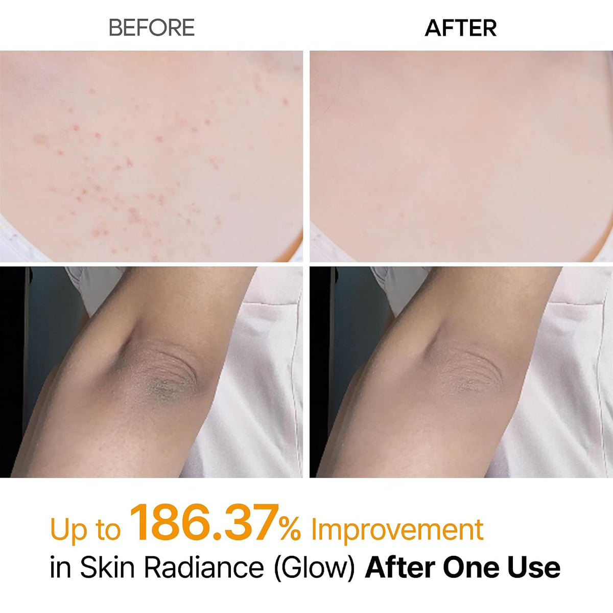 Dr.Melaxin Peel Shot Kojic Acid